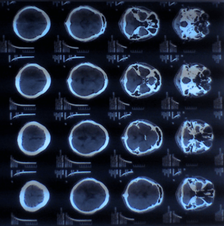 Screenshot 2017-06-27_15-02-10.png